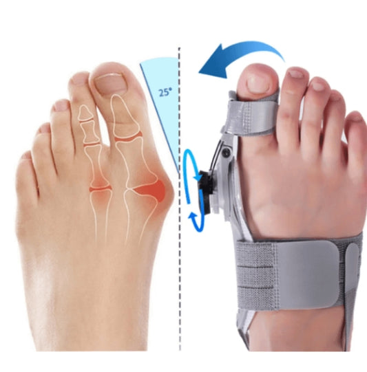 TeoComfort| sig farvel til din hallux valgus