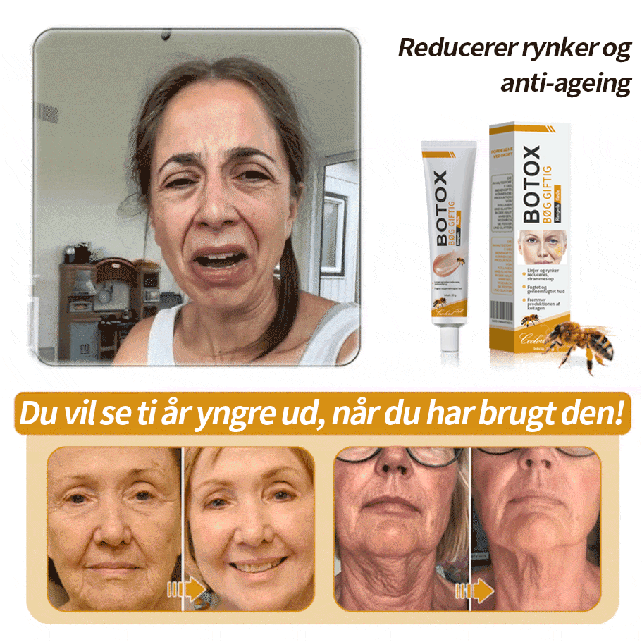 Anti-Rynke™ Botox Bee Venom Wrinkle Removal Cream