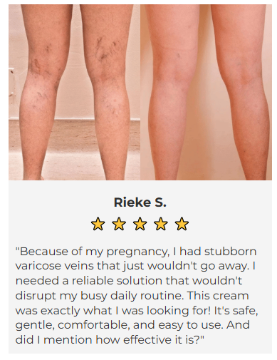VaricoEase™ - VeinClear Cream - Reducerer synligt åreknuder og hjælper dig med at få glatte, sunde ben på bare 7 dage! (1+1 GRATIS)