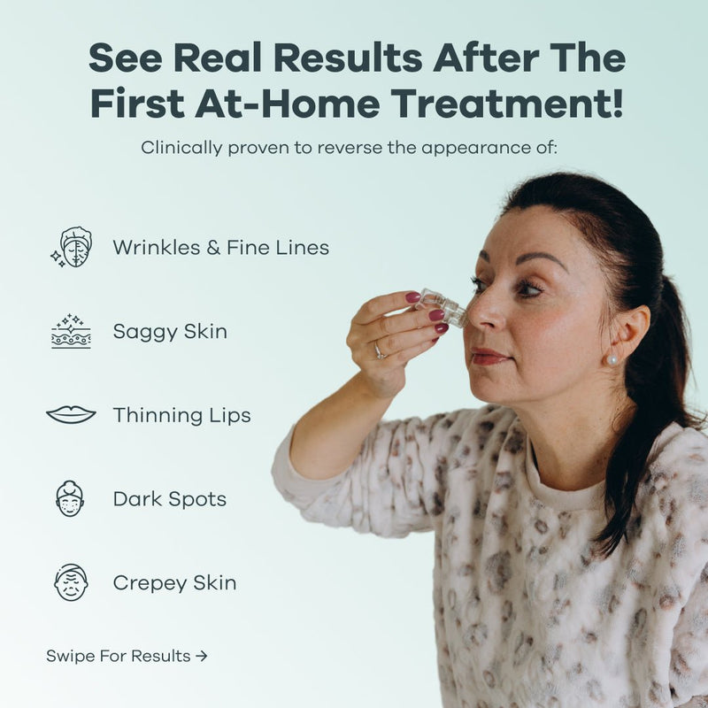 YOOLI™ Microneedle Infusion | Slip af med rynker på 3 uger