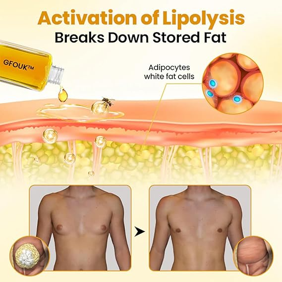 GFOUK™ ThermoFirm Bijengif Gynecomastie Olie (1+1 GRATIS)