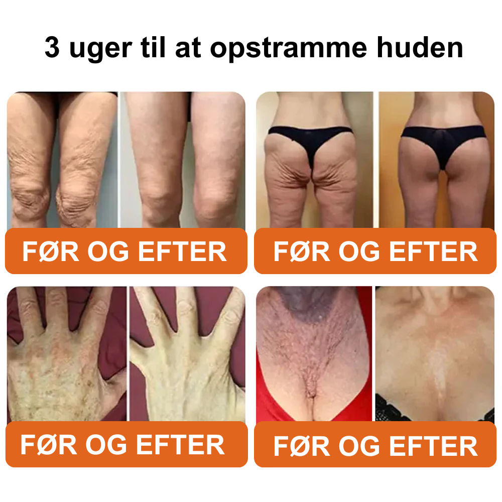 SilkeFast® Naturlig glathed. Synlig fasthed