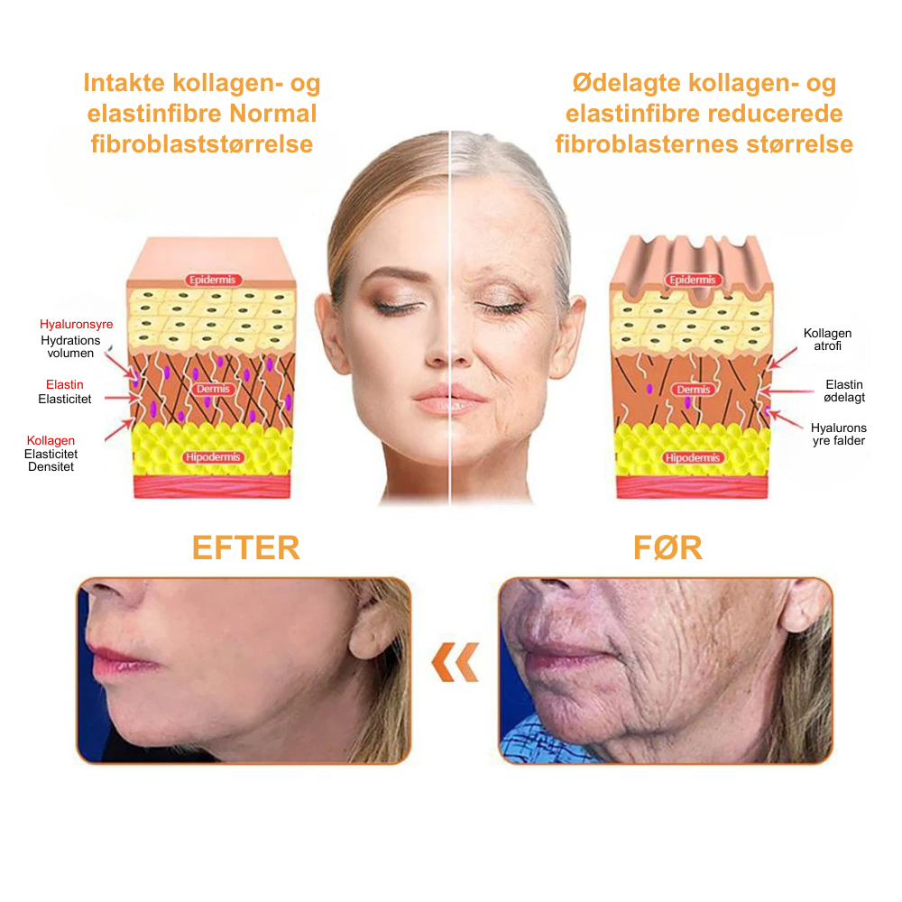 SilkeFast® Naturlig glathed. Synlig fasthed