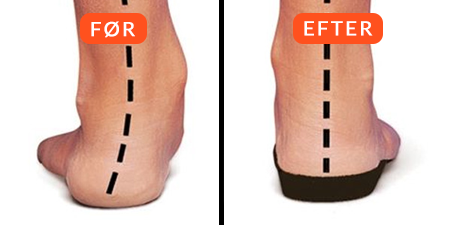 Sportiq™ PowerStep - Ortopædisk indlægssål til sko