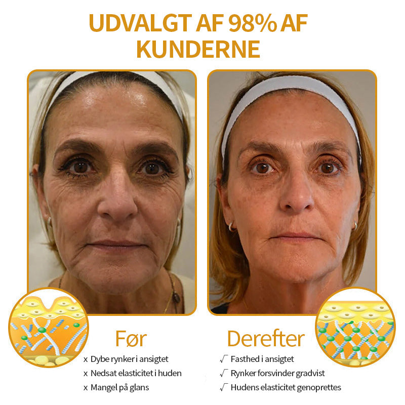 Anti-Rynke™ Botox Bee Venom Wrinkle Removal Cream