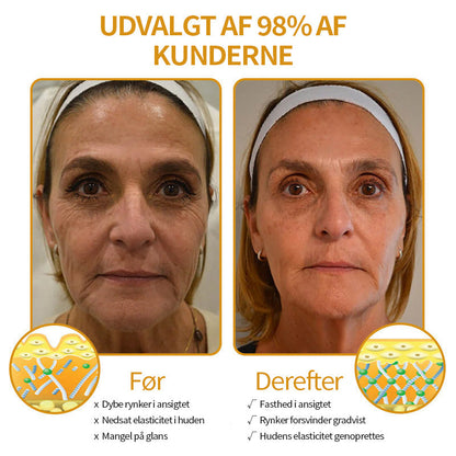 Anti-Rynke™ Botox Bee Venom Wrinkle Removal Cream