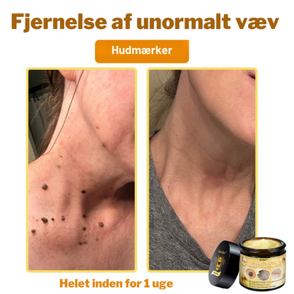 Bistille™ | All-in-One hudreparationscreme mod insektstik og irritation Dermatologisk testet og anbefalet i Danmark ( Anbefalet af DDS)