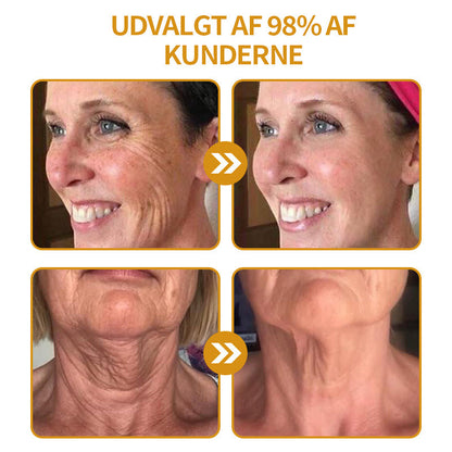Anti-Rynke™ Botox Bee Venom Wrinkle Removal Cream