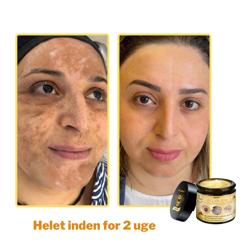 Bistille™ | All-in-One hudreparationscreme mod insektstik og irritation Dermatologisk testet og anbefalet i Danmark ( Anbefalet af DDS)