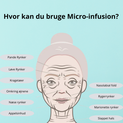 Micro-Infusion Løfte Kit™