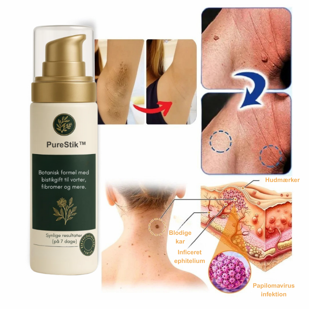 PureStik™ | Farvel til hudmærker og rynker med bi-gift – hjemmefra på få dage!