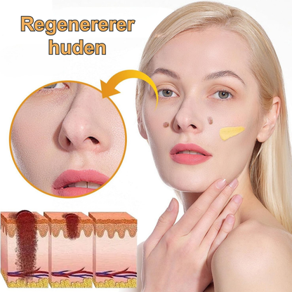 PureStik™ | Farvel til hudmærker og rynker med bi-gift – hjemmefra på få dage!