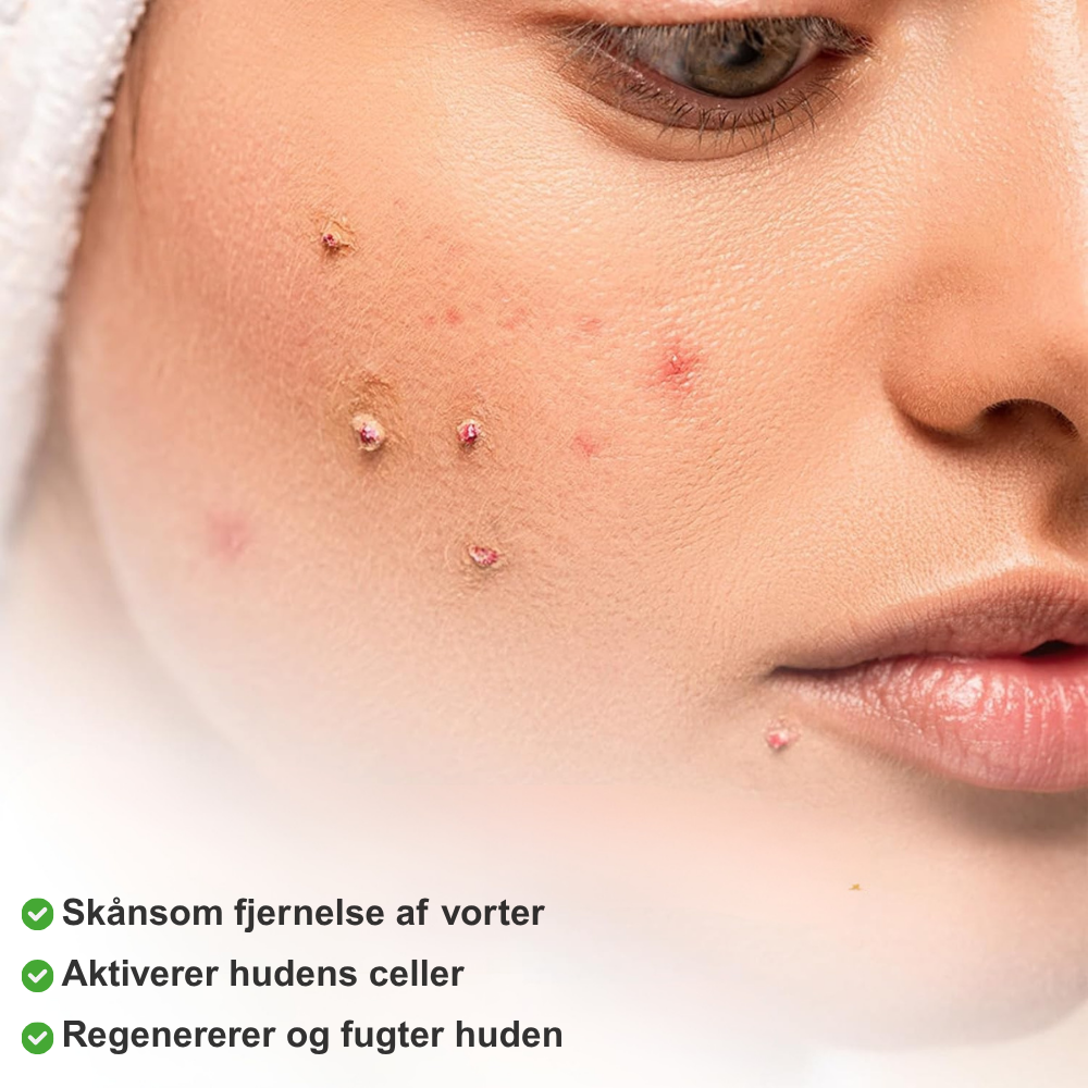 PureStik™ | Farvel til hudmærker og rynker med bi-gift – hjemmefra på få dage!