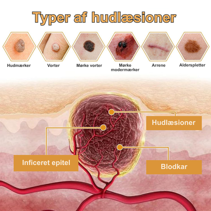 PureStik™ | Farvel til hudmærker og rynker med bi-gift – hjemmefra på få dage!