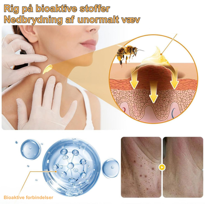 PureStik™ | Farvel til hudmærker og rynker med bi-gift – hjemmefra på få dage!