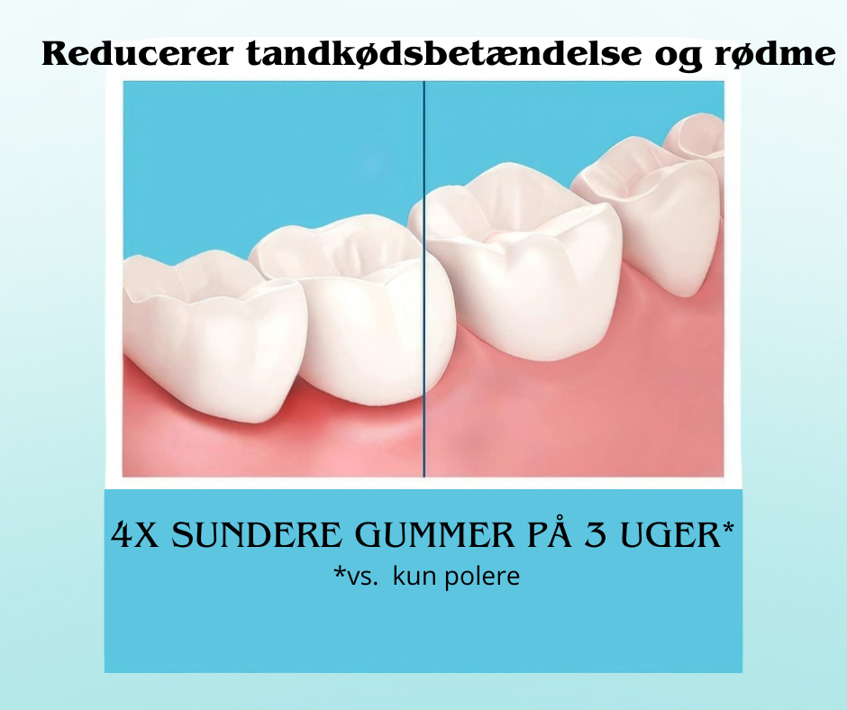 TandSkum™ | Skånsom Tandblegningsmousse