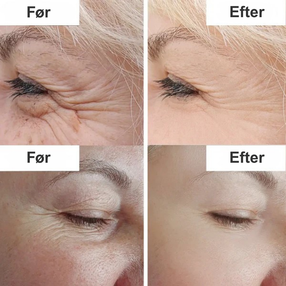 NeoHud™ | Rul tiden tilbage – få ungdommelig hud igen med biomimetisk teknologi!