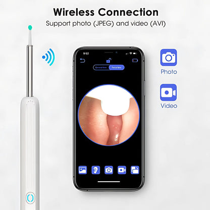 OtoPure™ – Avanceret Ørerens med HD-kamera for Maksimal Præcision!