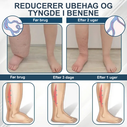 Cvreoz® – Afgiftende urtecreme med sort kommen