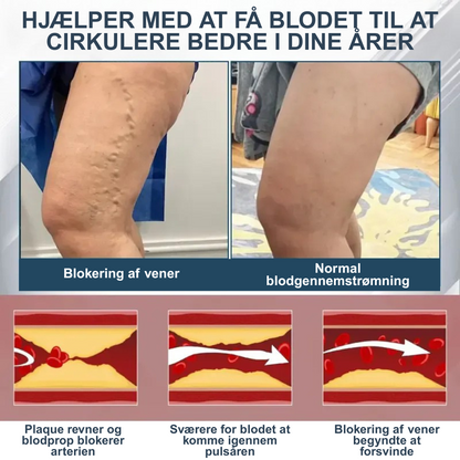 Cvreoz® – Afgiftende urtecreme med sort kommen