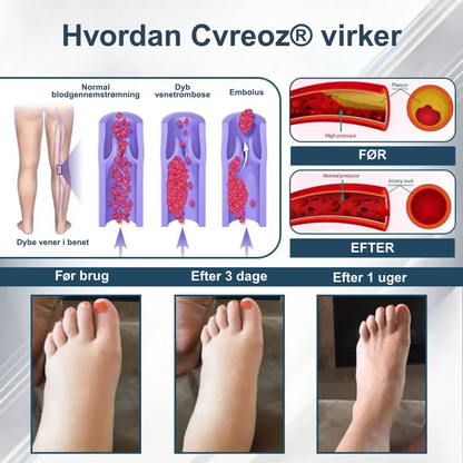 Cvreoz® – Afgiftende urtecreme med sort kommen