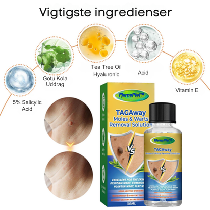 FjernsPlet™ – Effektiv behandling på 7 dage