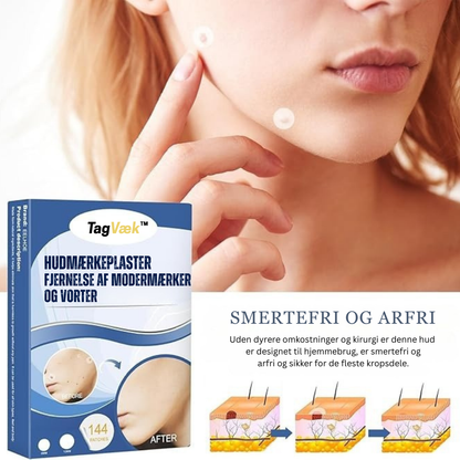 TagVæk™ – Fjern hudmærker på kun 5 dage