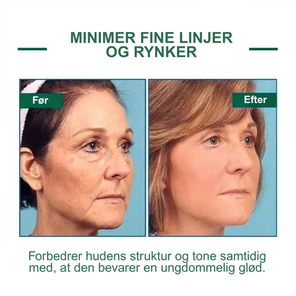 Eelhoe™ – Opstrammende og regenererende serum