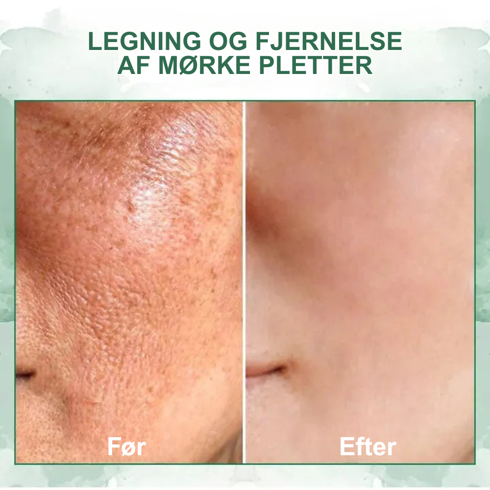Eelhoe™ – Opstrammende og regenererende serum
