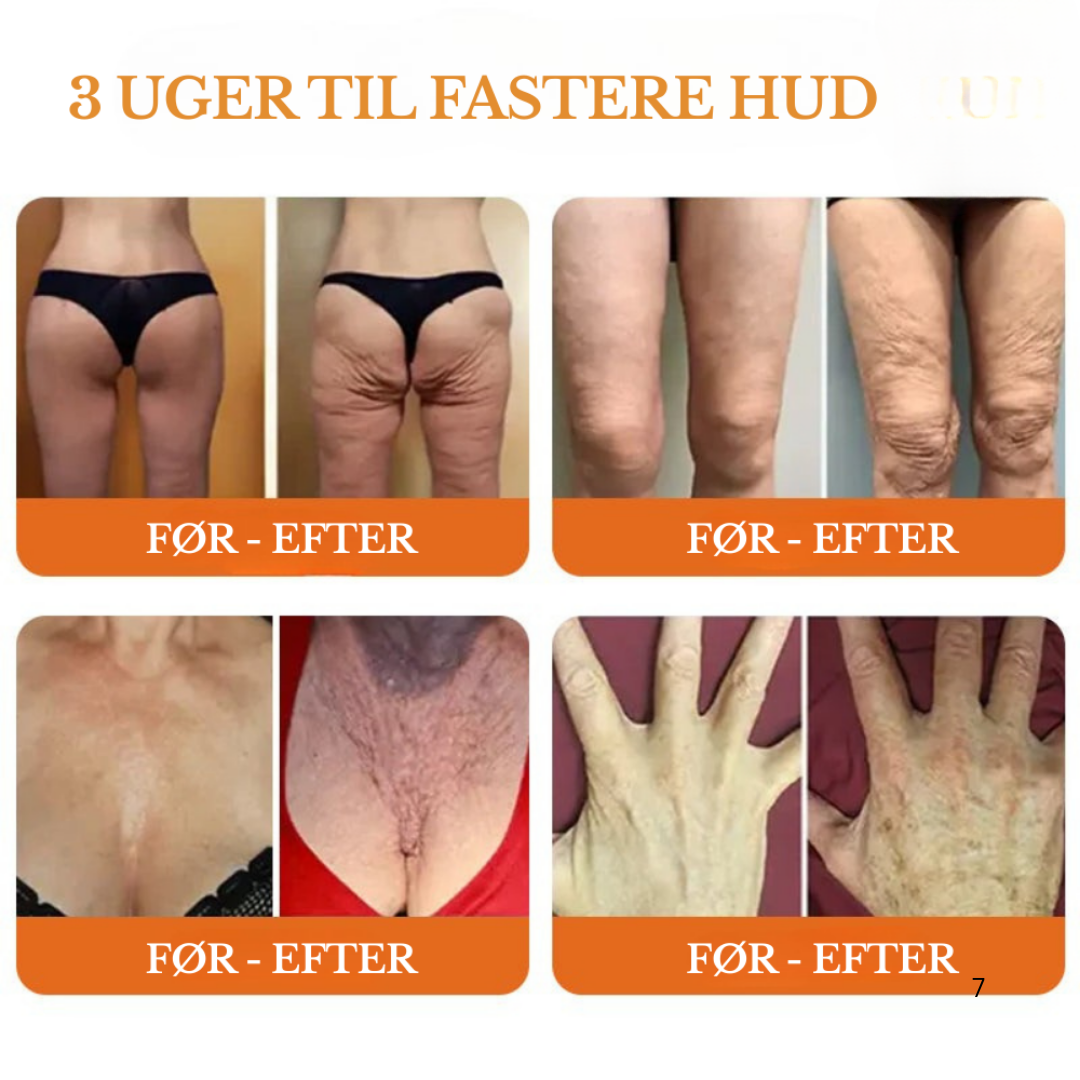 GlowFix™ Løftestick