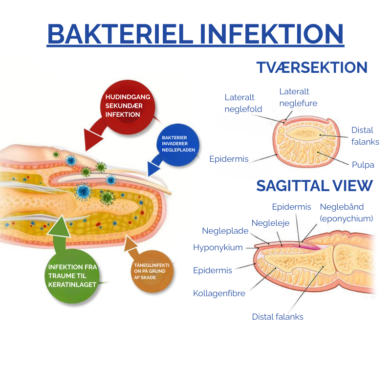 MycoLight™ Skånsom behandling mod neglesvamp