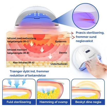 MycoLight™ Skånsom behandling mod neglesvamp