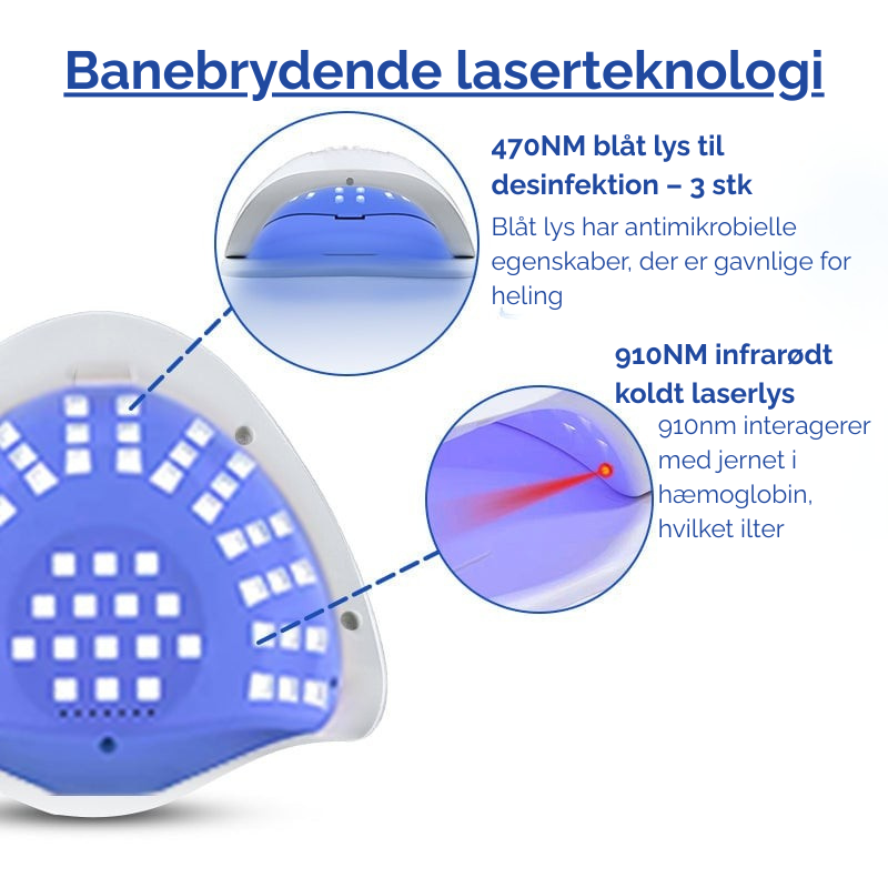 MycoLight™ Skånsom behandling mod neglesvamp