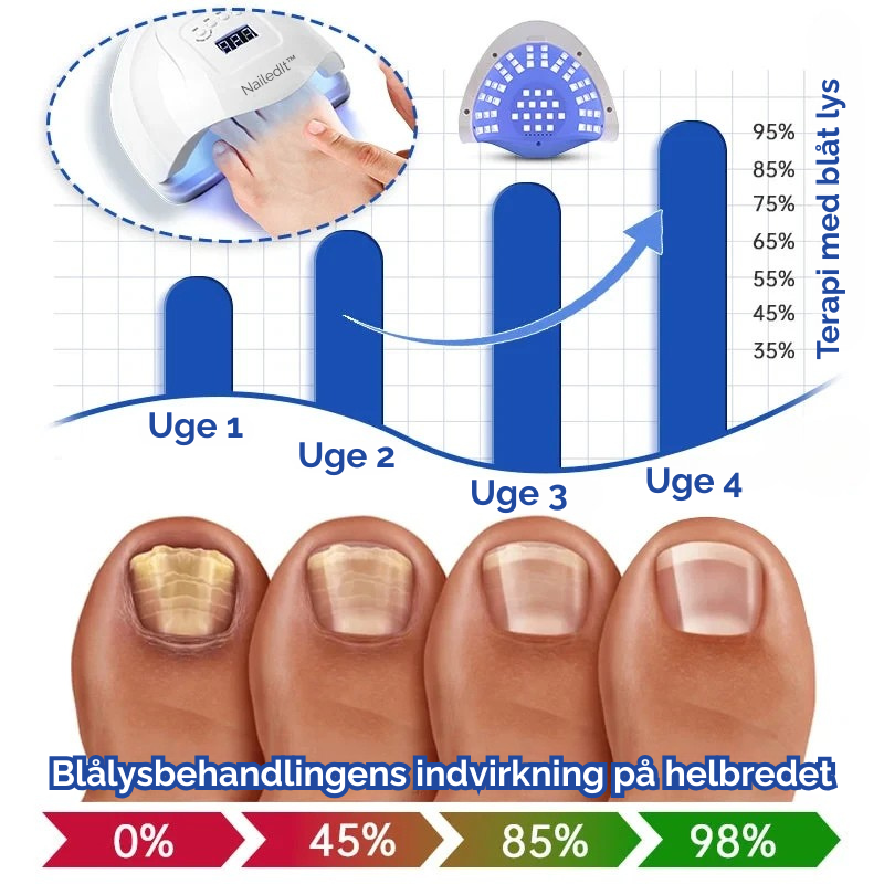 MycoLight™ Skånsom behandling mod neglesvamp