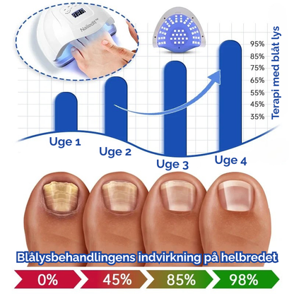 MycoLight™ Skånsom behandling mod neglesvamp