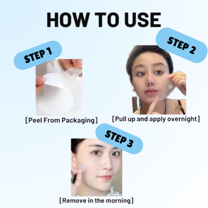 LøftLine™ – 3D Opstrammende Smilelinje-Maske