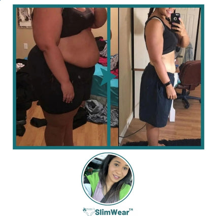 SlimWear™ Detox Shorts | Tab 7 kg mavefedt på 5 dage!