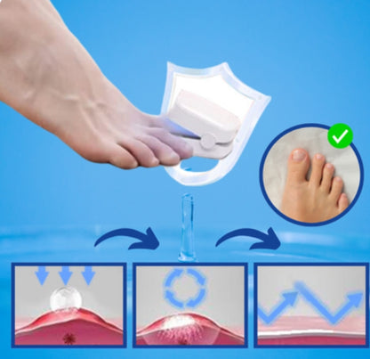 LumiNail™ - Slip af med tykke, misfarvede negle én gang for alle!