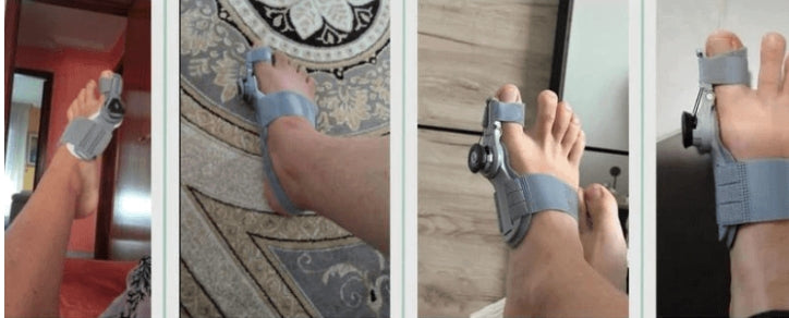 TeoComfort| sig farvel til din hallux valgus