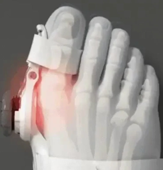 TeoComfort| sig farvel til din hallux valgus