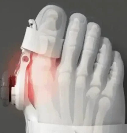 TeoComfort| sig farvel til din hallux valgus