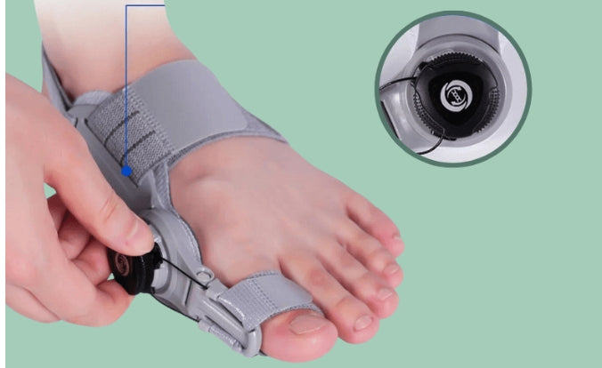 TeoComfort| sig farvel til din hallux valgus