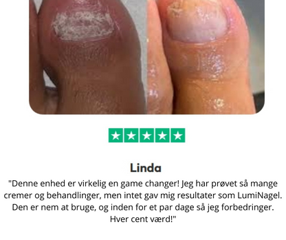 LumiNail™ - Slip af med tykke, misfarvede negle én gang for alle!