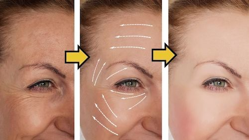 TermaSkin™ SpaLift | anti-rynke serum