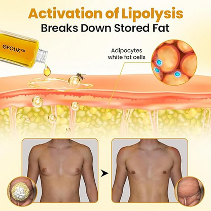 GFOUK™ ThermoFirm Bijengif Gynecomastie Olie (1+1 GRATIS)