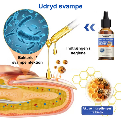 Furzero™ En komplet løsning på problemet med neglesvamp (1+1 GRATIS)