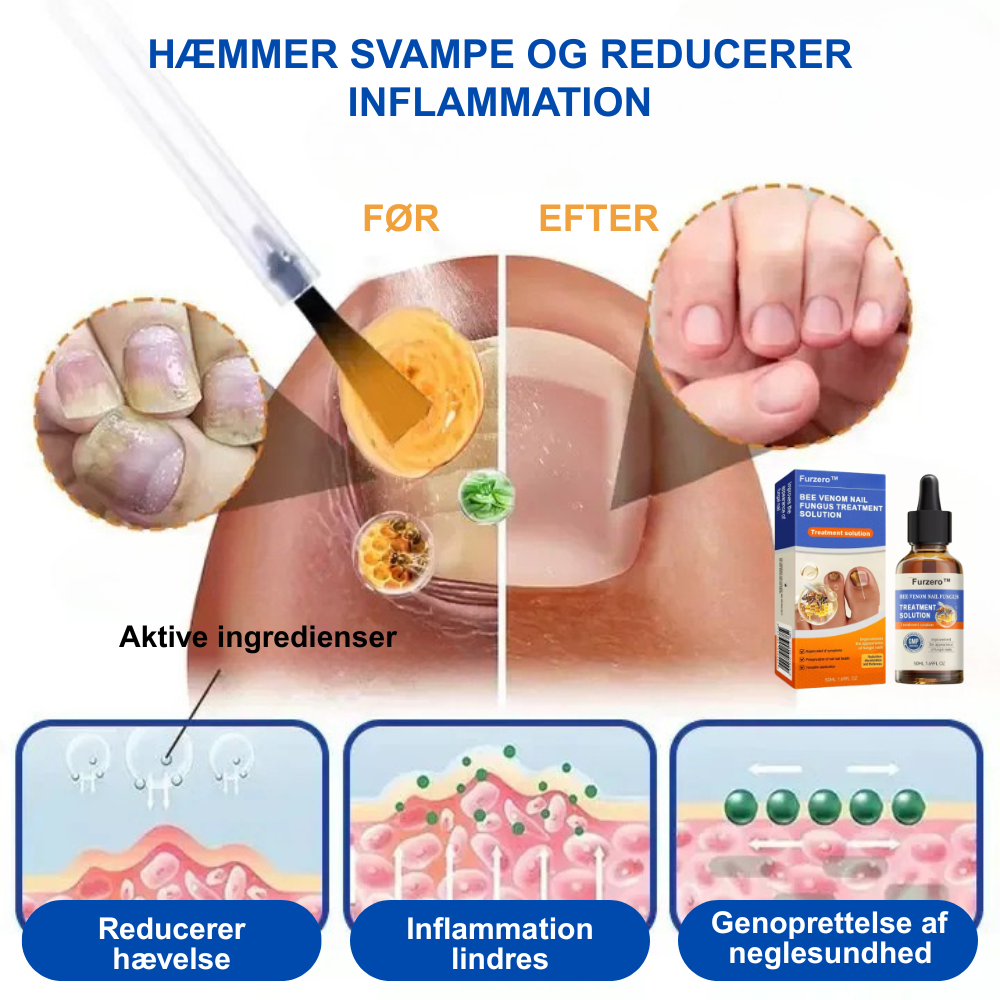 Furzero™ En komplet løsning på problemet med neglesvamp (1+1 GRATIS)